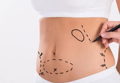 Karın Germe Ameliyatı